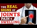 Top 5 Sign and Symptoms of Arthritis | आर्थराइटिस के मत्वपूर्ण लक्षण
