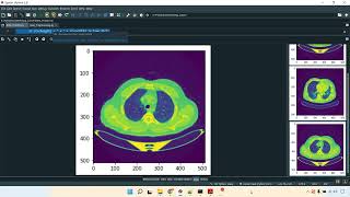 Lung Pancreatic Cancer CNN Train Flask App in Python Projects