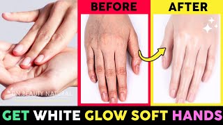 ✋Best Remedy Get White Glow Soft and Smooth Hands, Fix Wrinkled & Dry hands, Beautiful fingers screenshot 2