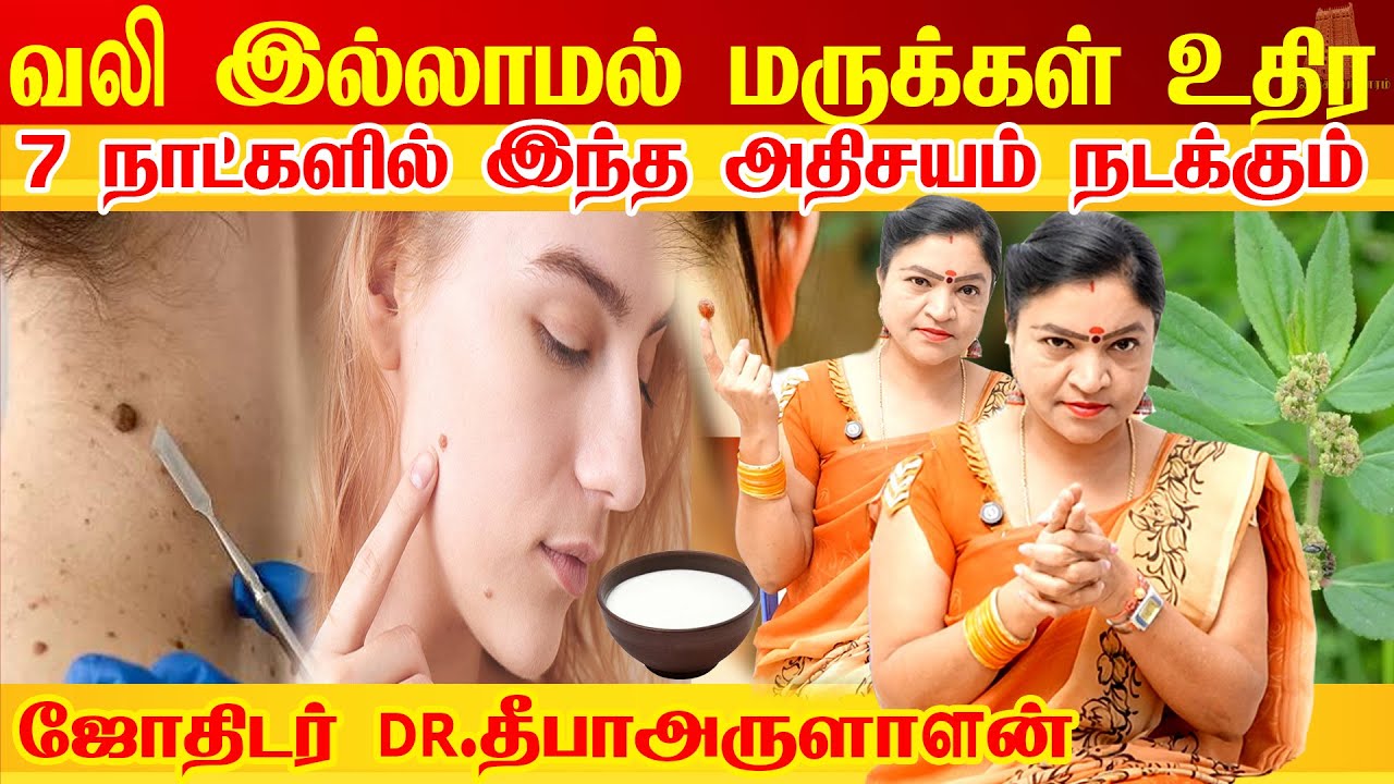 7 நாட்களில் மருக்கள் உதிர எளிய வழி | மருவை நிரந்தரமாக நீக்கும் மூலிகை |How to remove warts naturally
