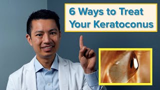 The 6 Best Ways to Treat Your Keratoconus screenshot 1