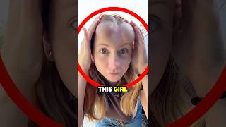 She Is AFRAID To Go Out In Public Because Of This!😳😱 (@sincerelyjord)