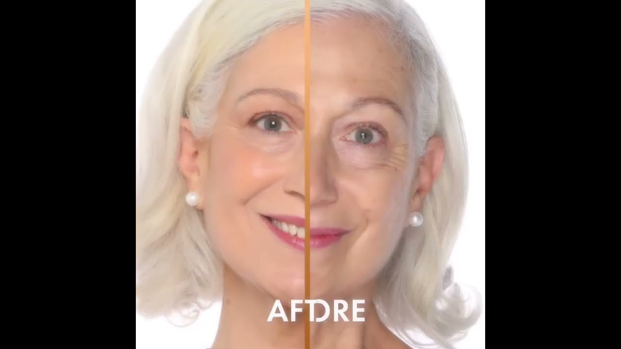 Flawless Complexion Unveiled | Jerome Alexander