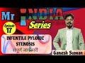 Infantile pyloric stenosis by @GANESH_NURSING_WALLAH 