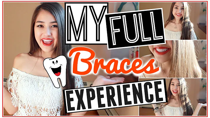 My FULL Braces Experience!  Everything You Need to...