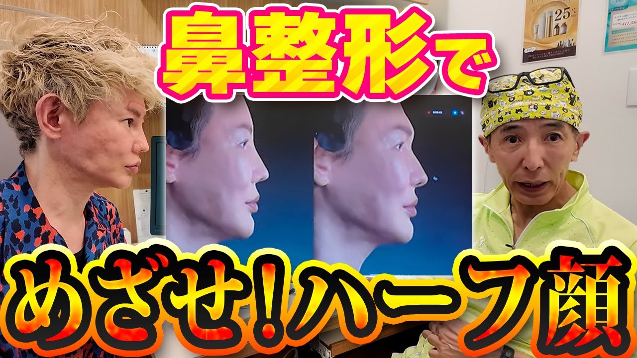 【鼻整形】めざせ！ハーフ顔！色んな鼻の形をシュミレーションしてきました。