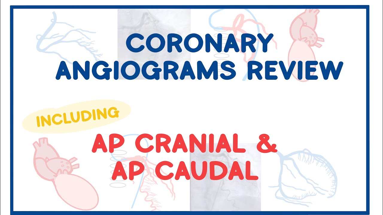 Коронарные проекции I, включая передне-заднюю краниальную и передне-заднюю каудальную.