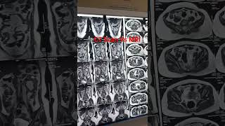 CT scan Vs MRI, technology #mbbs #medicos #clinic #study