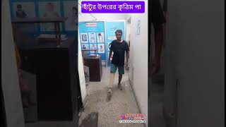 কম খরচে হাঁটুর উপরের আধুনিক কৃত্রিম পা,moving knee joint artificial leg  ✆  01324-999424 #কৃত্রিম_পা