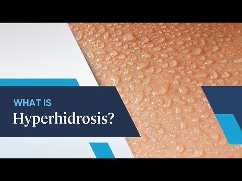 What is Hyperhidrosis?