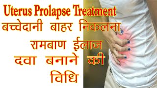 Uterus Prolapse Treatment II यूटरस/बच्चेदानी बाहर निकलना- आयुर्वेदिक इलाज