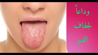 هل تعاني من جفاف الفم  إليك العلاج النهائي لجفاف الفم و الرائحة الكريهة في الفم