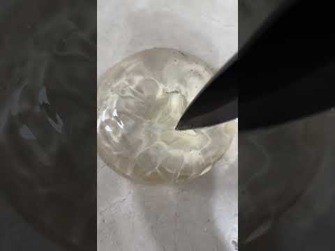 How Durable Is A Breast Implant Reno Implants Dr Erez Dayan Avance Plastic Surgery