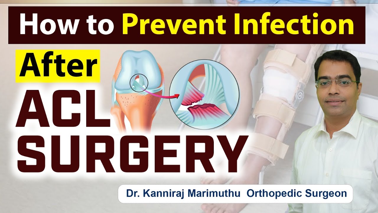 🦵ACL Surgery Infection Prevention 🛑 How to prevent infection after ACL ...