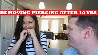 REMOVING MY TONGUE RING AFTER 10 YEARS