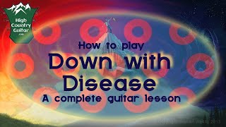 How to play Down With Disease by Phish
Part 1 of 2: How to play the main part of Down With Disease by Phish (verses, choruses, etc). Part 2 will look at the improvised part.
Find it all at HighCountryGuitar.com
https://highcountryguitar.com/lessons/phish-down-with-disease-full-length-guitar-lesson/ How to play Down With Disease by Phish