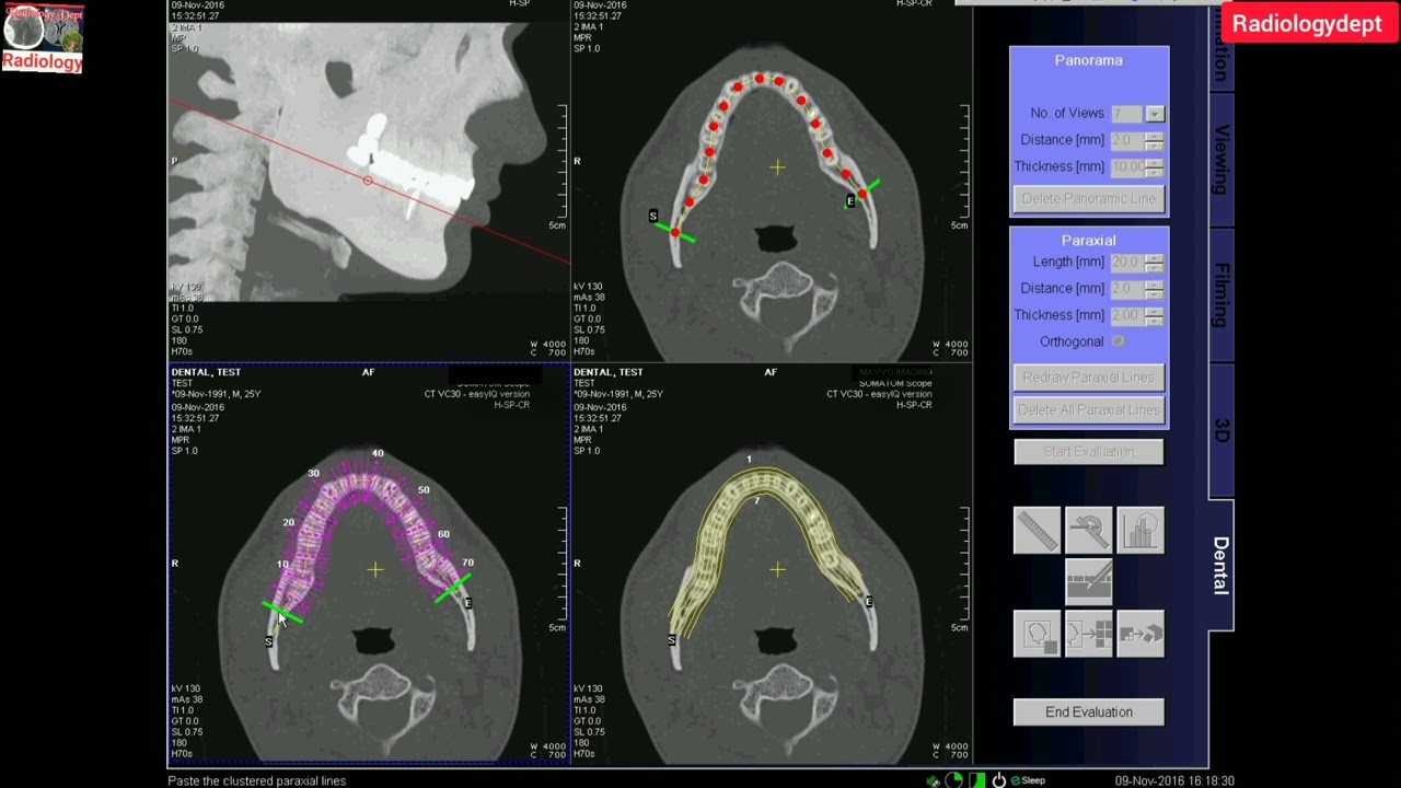 Dental CT Scan Technique in Hindi | 