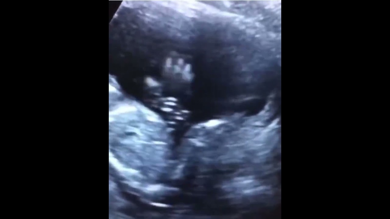 It's the same inside and outside her mother's womb😂