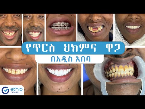 ቪዲዮ: እብጠትን ከንፈሮችን እንዴት ማከም እንደሚቻል -14 ደረጃዎች (ከስዕሎች ጋር)