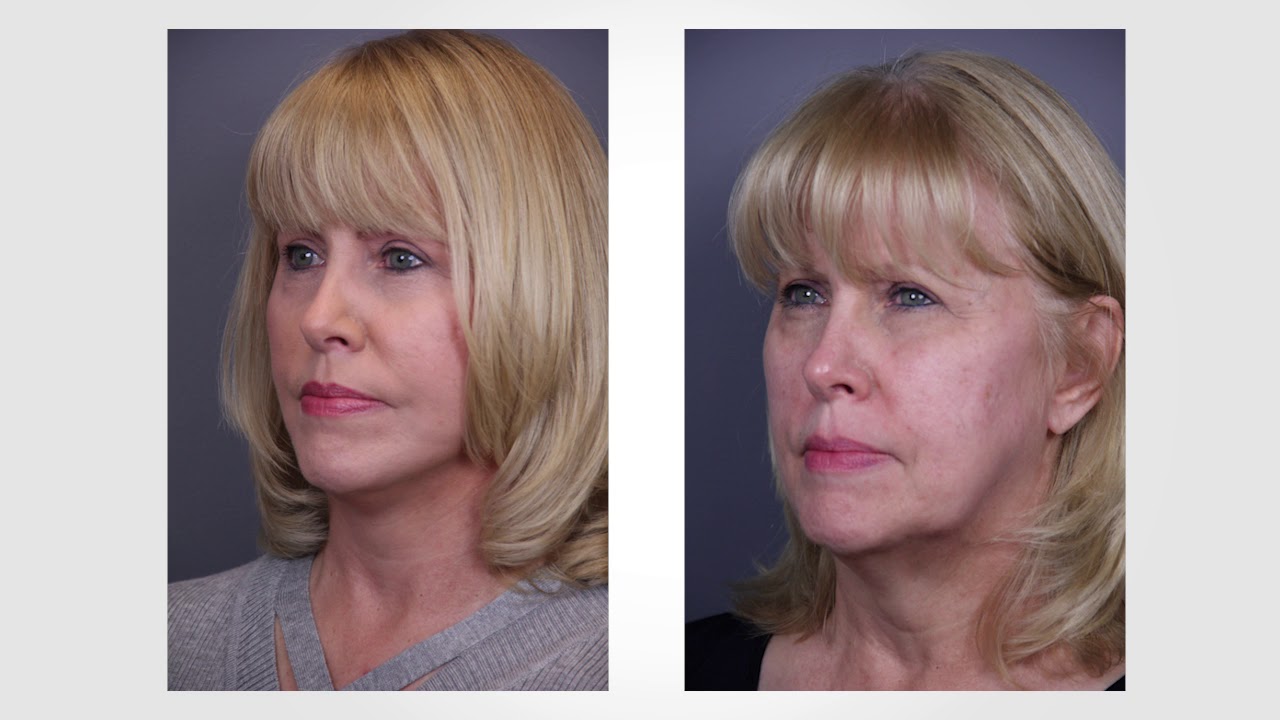 facetit photo sliders - YouTube