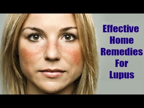 Home remedies for