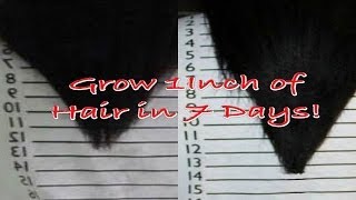 The Inversion Method | Grow 1-2 Inches of Hair in 7 Days! Profile
