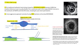 IVUS/OCT stent guidance, pre- and post-stenting