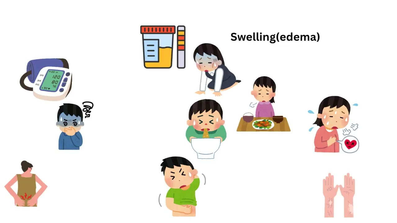 Kidney condition in children 