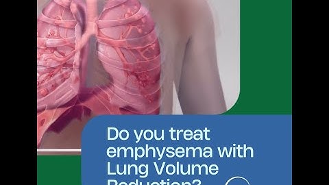 Personalised Treatment for Emphysema with Bronchoscopic Thermal Vapor Ablation (BTVA) – InterVapor