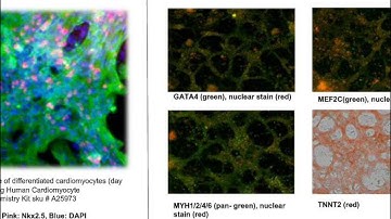 PSC Cardiomyocyte Differentiation Kit – PSCs to cardiomyocytes in three steps
