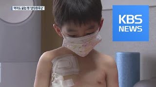 먹어도 굶는 병 ‘단장증후군’…신약은 ‘희망고문’ / KBS뉴스(News)