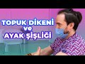 Ayakta şişlik, Topuk Dikeni - Bülent Aydın