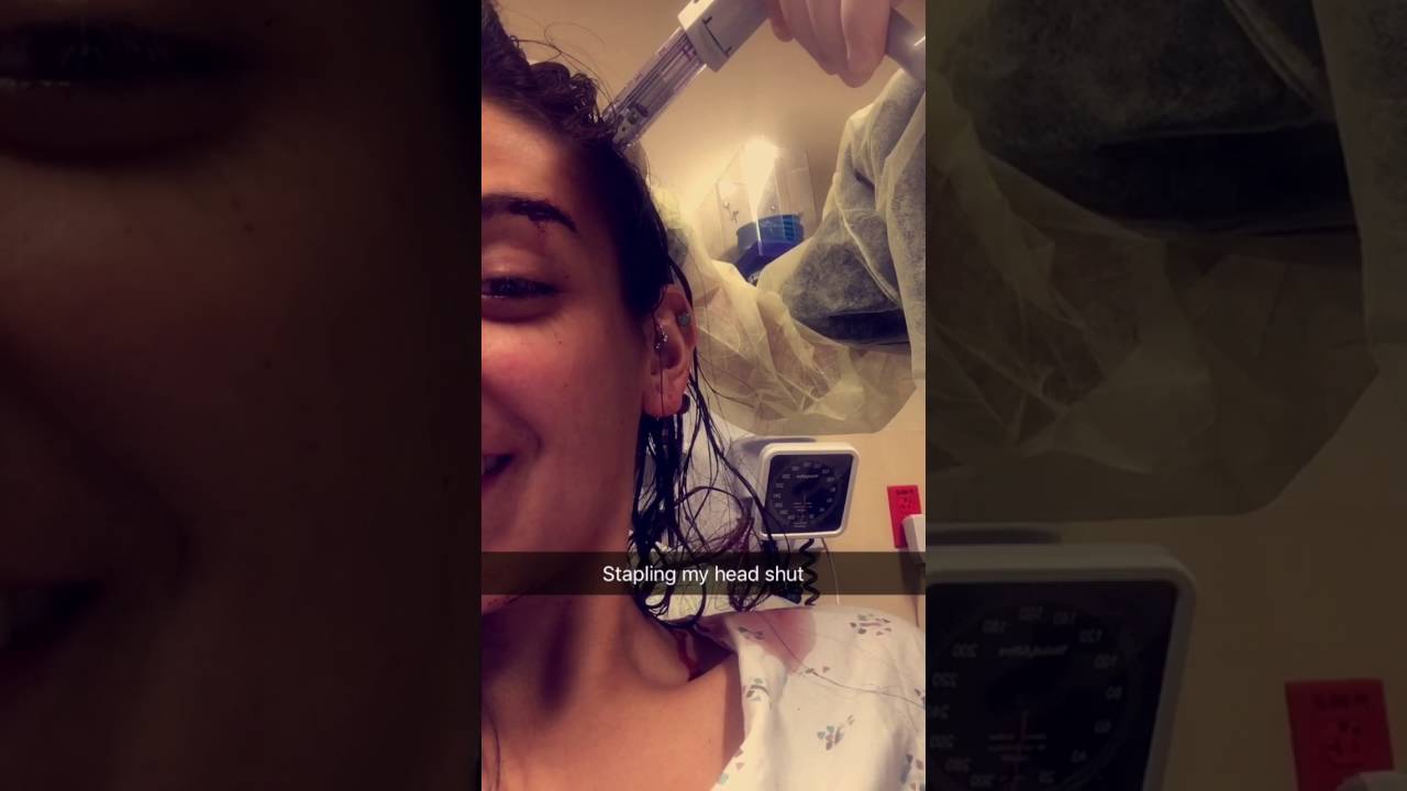 Head injury caused 6 staples YouTube