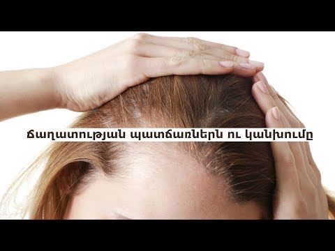 Video: Որոնք են կանանց մազերի հետ կապված նշանները