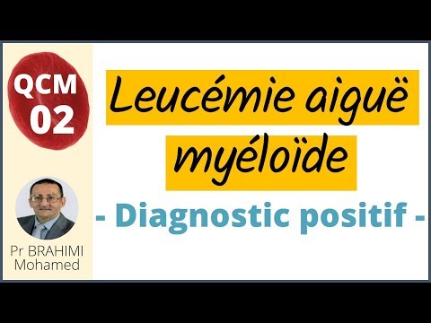 Vidéo: Crise Blastique Ph + Leucémie Myéloïde Chronique Avec NUP98 / HOXA13 Régulation Positive MSI2