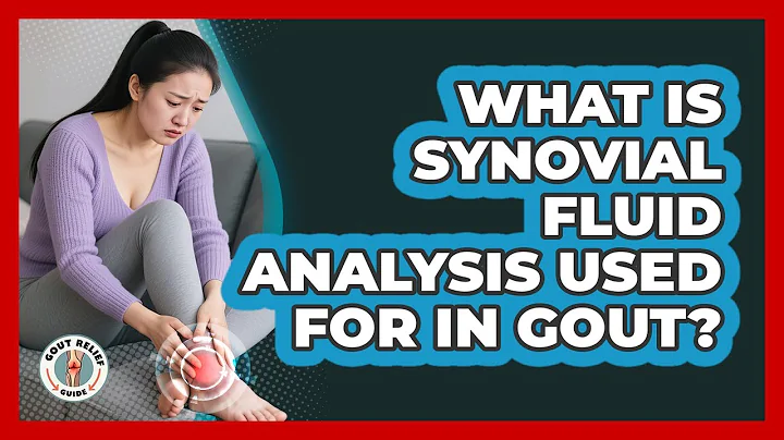 What Is Synovial Fluid Analysis Used For In Gout? - Gout Relief Guide
