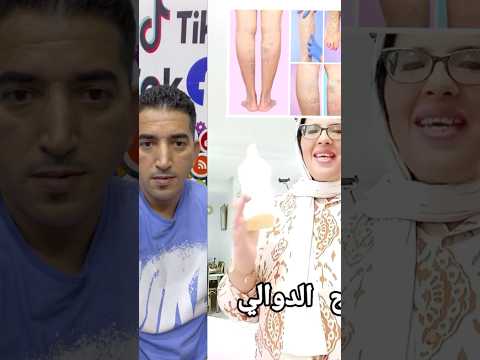 وصفه لعلاج الدوالي بارطاجي  النظافه