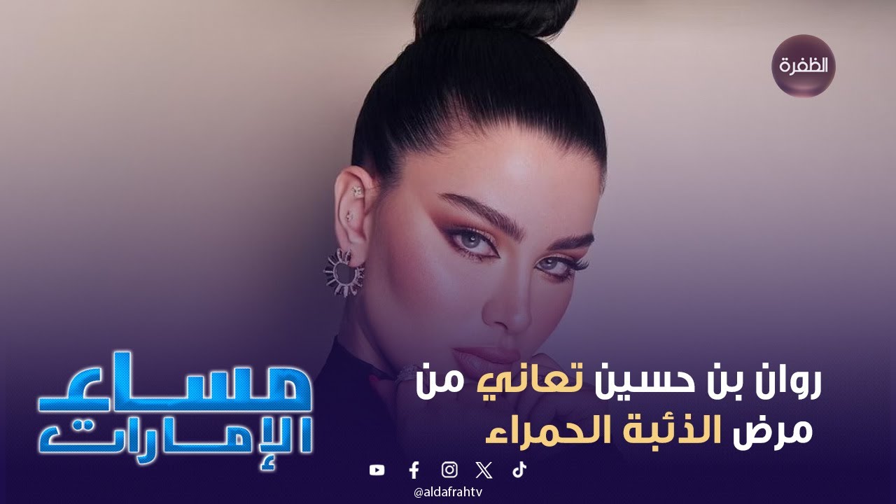 خبر إصابة روان بن حسين بمرض جلدي نادر اسمه الذئبة الحمراء