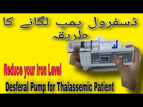 Iron chelation / How do you use a Desferol pump?