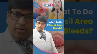What To Do If Tonsil Area Bleeds? Bleeding Tonsils Post Surgery #decc #throatbleeding
