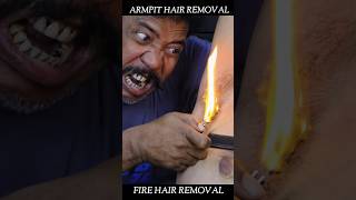 Underarm Hair Removal