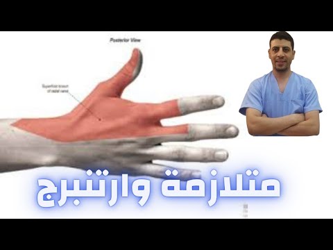 متلازمة وارتنبرج انحباس العصب الكعبري اختناق العصب الكعبري أسبابه وعلاجه دكتور احمد حسن جمعه
