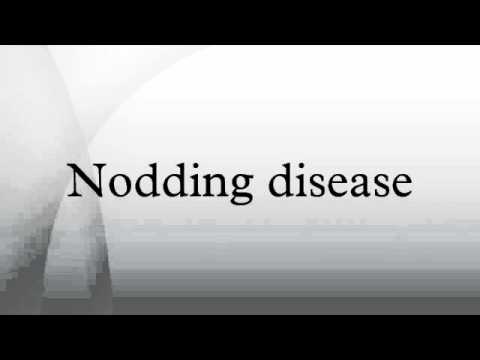 Nodding disease