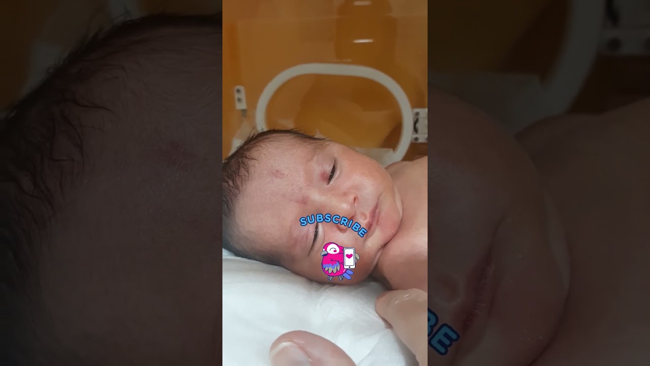 Stellar Beginnings: Adventures of the Tiniest Star!🍯🥰😍💕