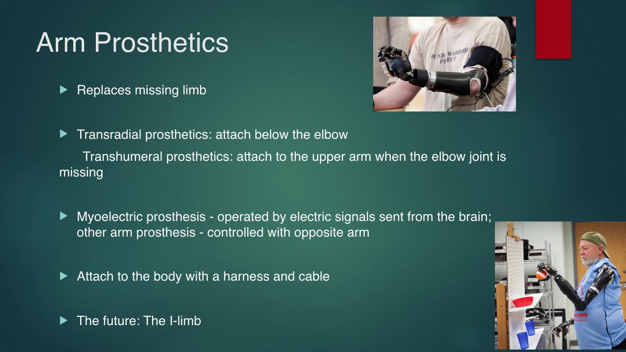 Types of Prosthetics and their Future YouTube