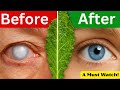 Seniors These Leaves Can Transform Your Vision Naturally Try These Vision Boosting Leaves