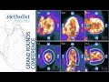 Positron Emission Tomography in Diagnosis and Management of CAD (Marcelo F. Di Carli, MD) 01/14/2021