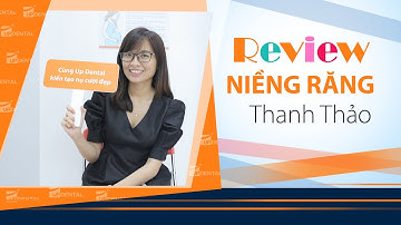 [Review niềng răng]: #163 Kết quả niềng răng của Thanh Thảo
