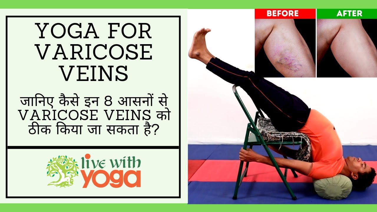Yoga For Varicose veins|| Lower body||yoga for veins - YouTube