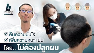 สักไรผม บอกลาศีรษะล้าน #ไม่ต้องปลูกผม